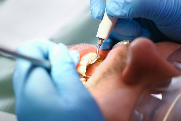 Best Emergency Treatment for Oral Infections in Maroa, IL
