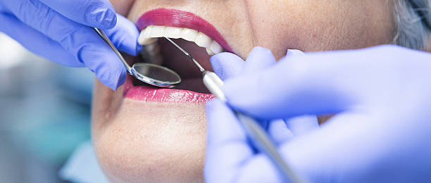 Best Broken or Chipped Tooth Repair in Maroa, IL